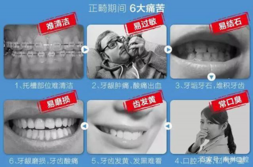 2025常州隐适美first儿童一期矫正大型正规口腔医院排行前10有哪些？常州二院口腔科资质和口碑在